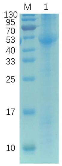 SDS-PAGE analysis of recombinant EKM-AM, His tag